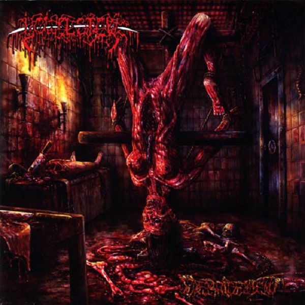 Bowel Stew: Debridement